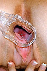 gyno6.jpg